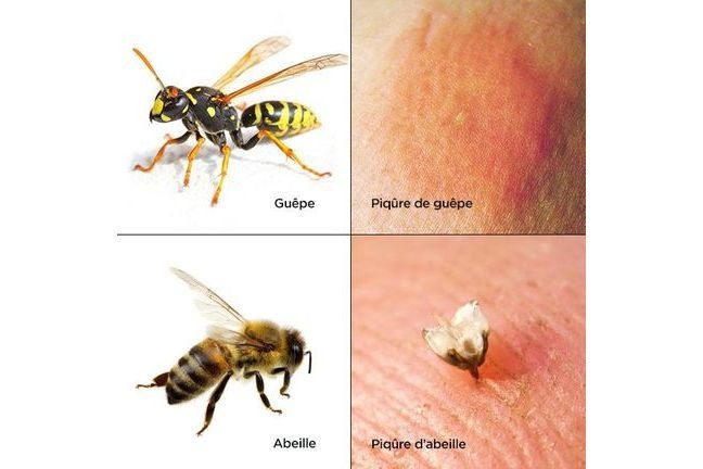 Piqûre de guêpe, frelon ou abeille : les soigner