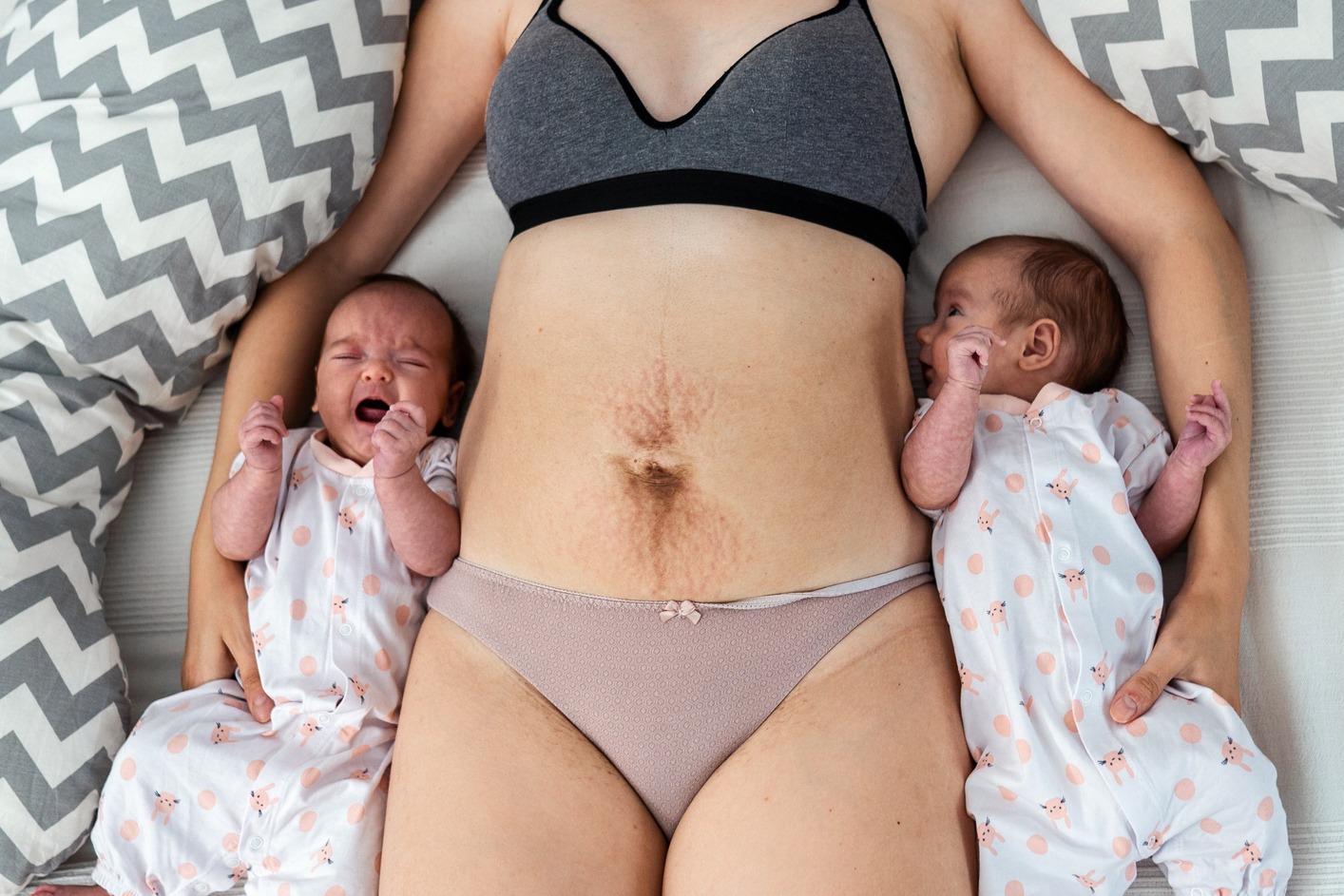 Quelle méthode opter pour la rééducation abdominale postnatale
