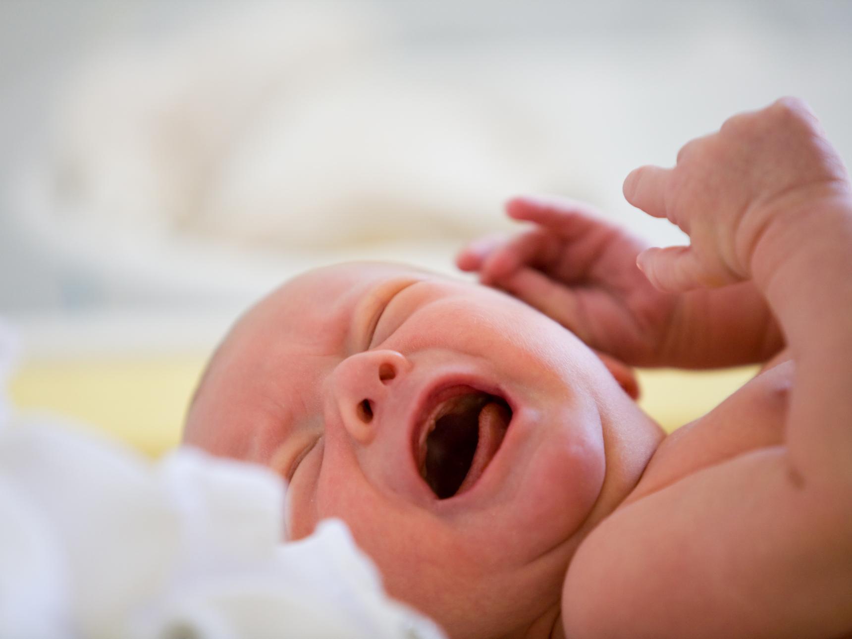 Acné du nourrisson : causes et traitements