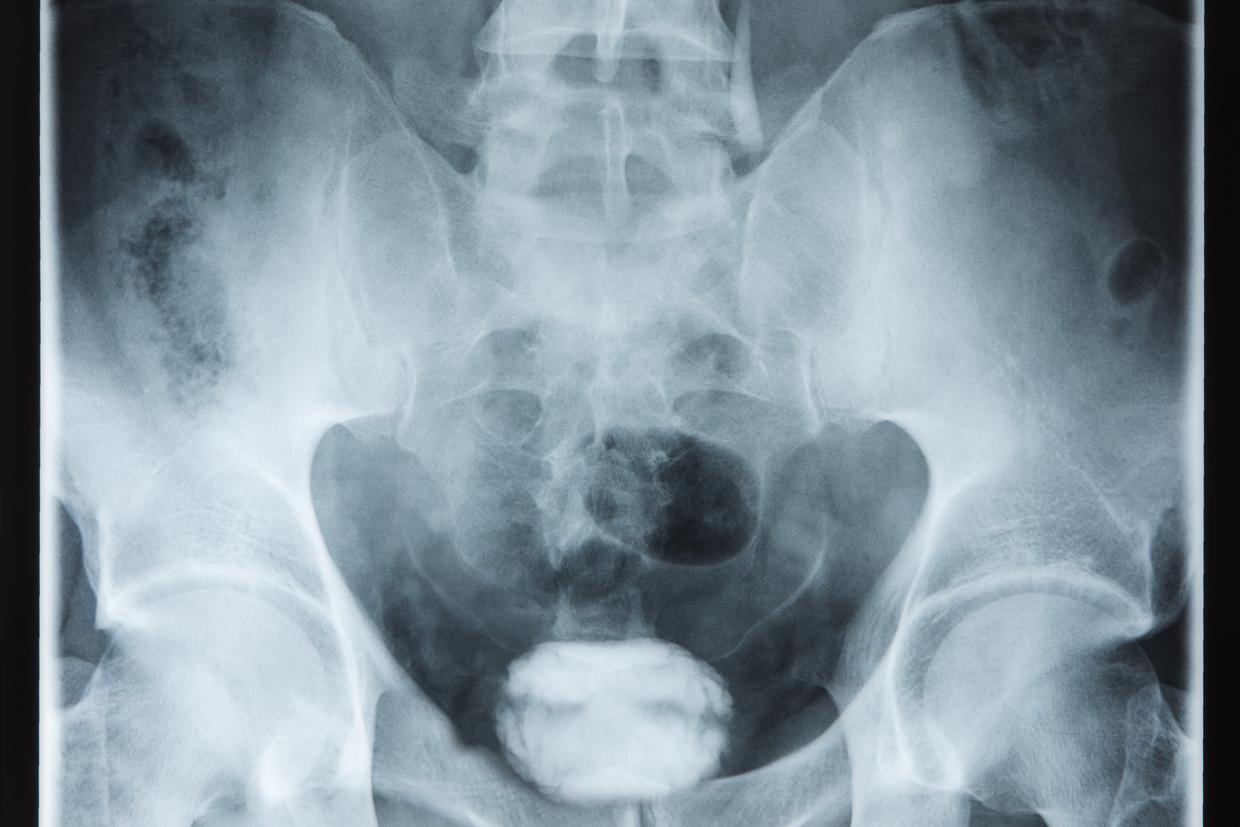 Arthroscanner indications d roulement pr cautions