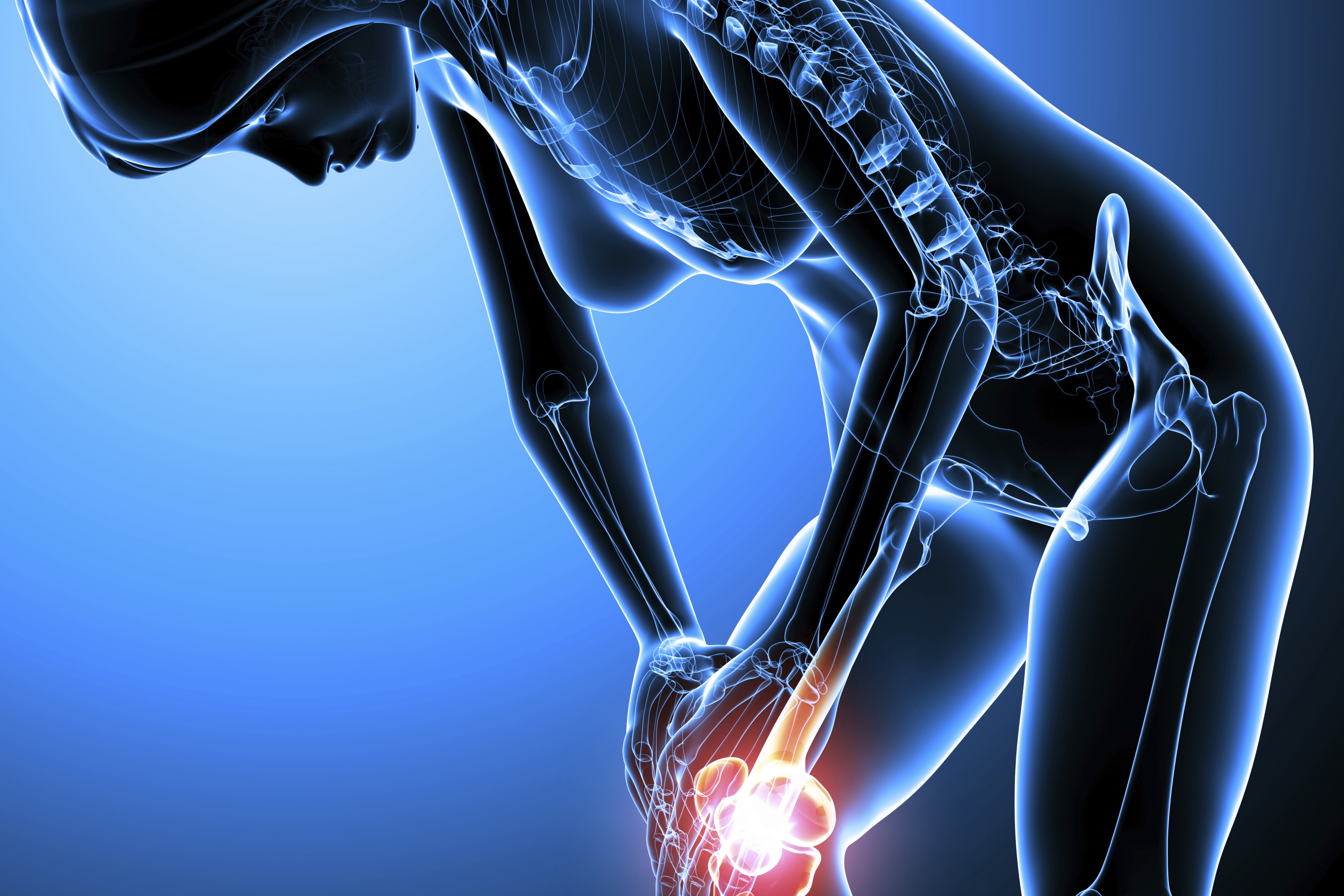 Définition, symptômes et diagnostic de l'arthrose de hanche