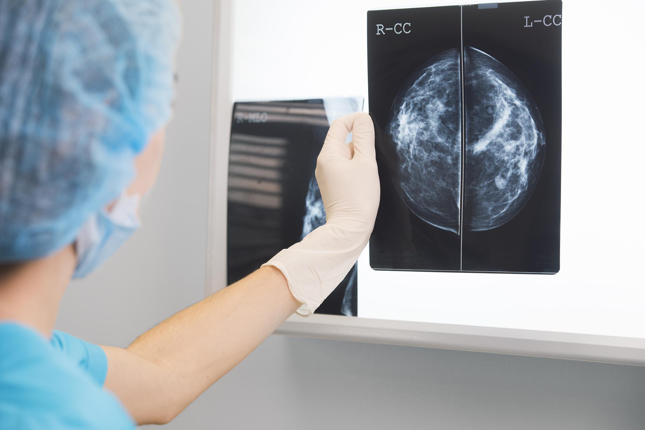 PHARMACIE ZANETTI - Cancer du sein : les 6 premiers symptômes ?
