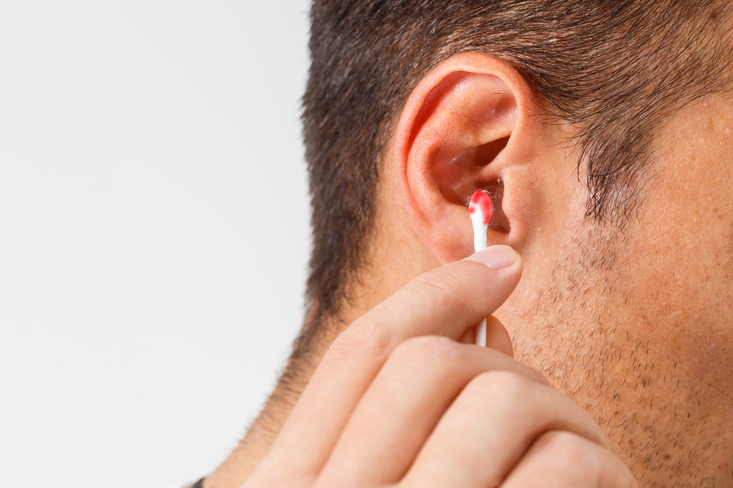 Bouchons de cérumen : une sensation d'oreille bouchée - Echos Santé