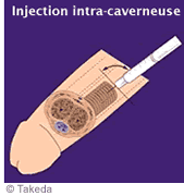 Les injections intra-caverneuses