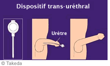 L'administration trans-uréthrale