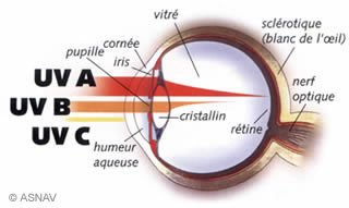 Les UV et les lésions oculaires