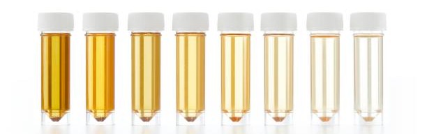 Couleurs urines - Signes hydratation et déshydratation