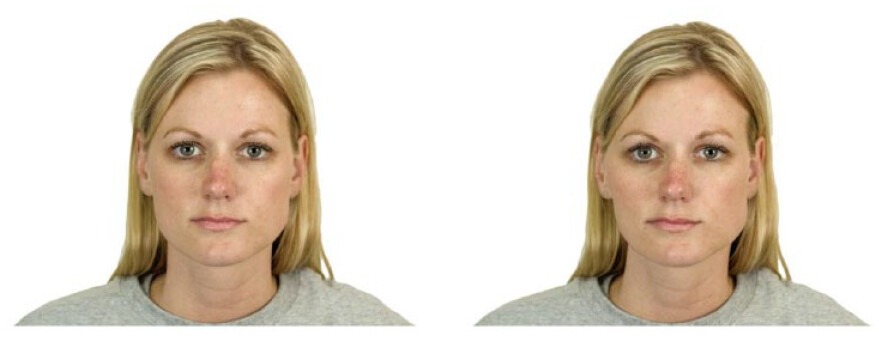 Le même visage affiché sous sa forme naturelle (panneau de gauche) et artificiellement asymétrisée (panneau de droite).