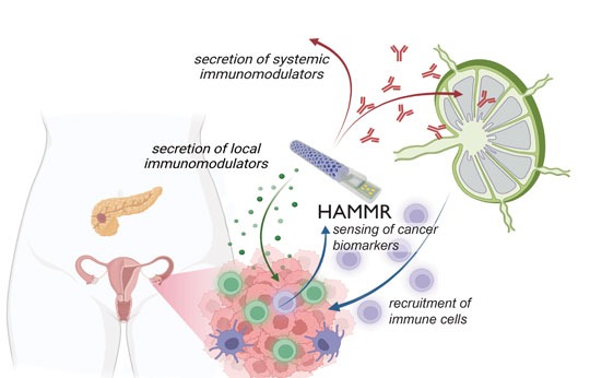 Schéma illustrant comment un implant "en boucle fermée" appelé HAMMR (abréviation de « hybride avancé » régulateur de fabrication moléculaire ») sera utilisé pour traiter le cancer de l’ovaire récurrent. 