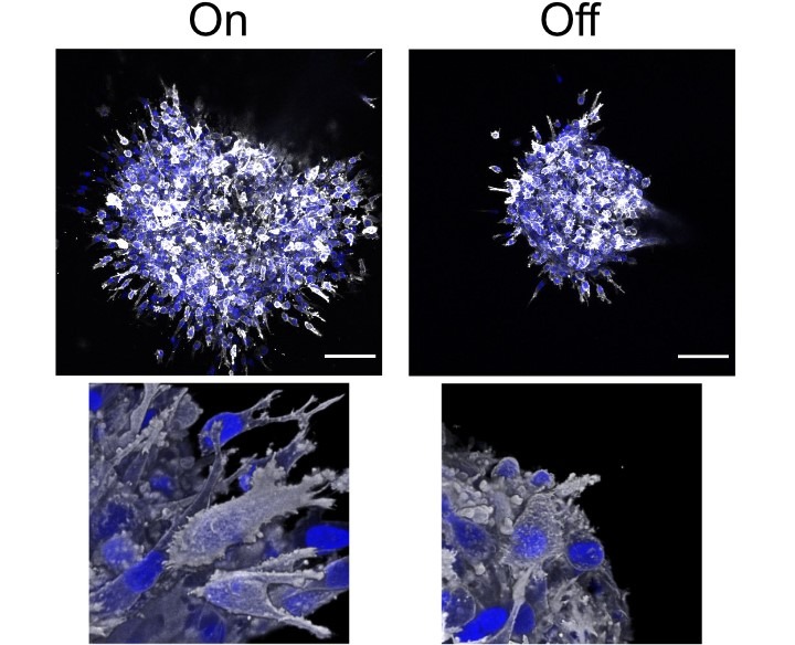 Illustration de la capacité d'invasion des cellules cancéreuses du sein avec (On) et sans (Off) stimulation par SMYD2 ; barre d‘échelle : 10µm.