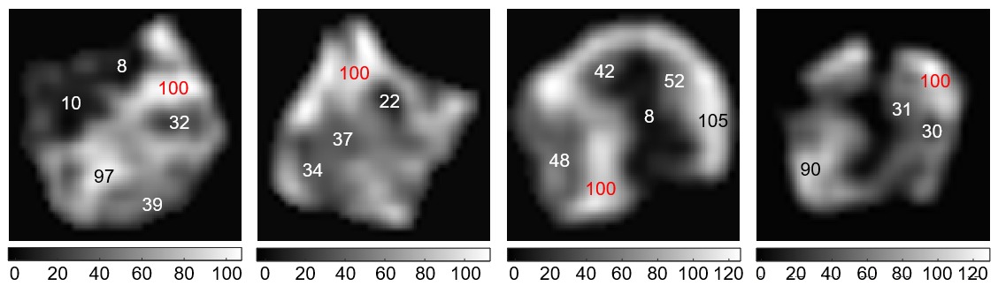 Les IRM des chercheurs montrent la quantité de myéline présente dans une zone donnée par rapport à d'autres zones de l'image.