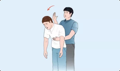 Diagram of the back slap technique