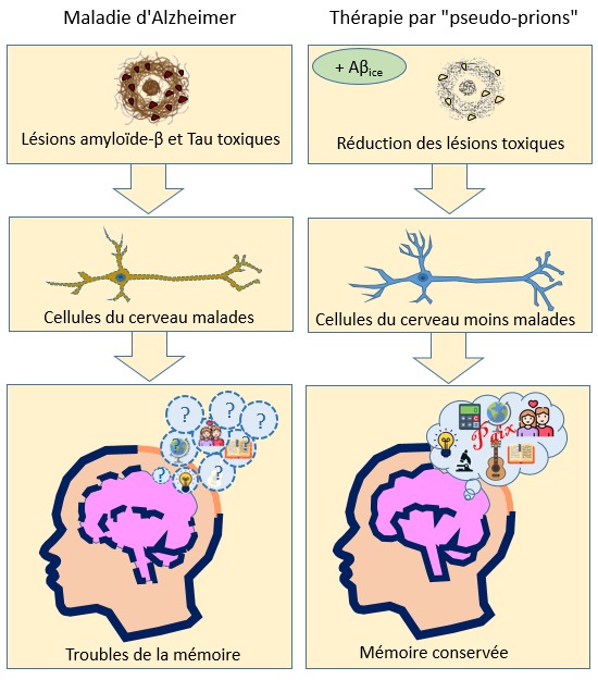 La thérapie par les pseudo-prions Aβice réduit les lésions toxiques de la maladie d'Alzheimer, protège les cellules du cerveau de la maladie et permet de protéger la mémoire. 