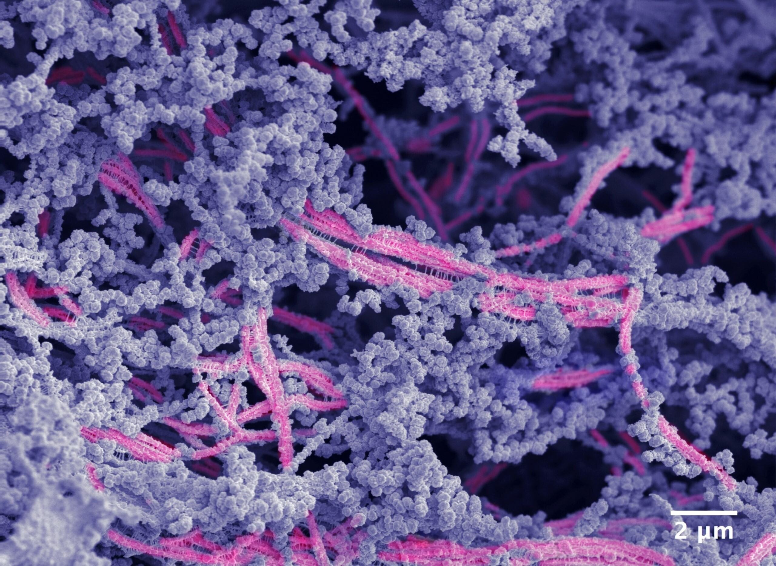 Microstructure du nouveau matériau bioactif. Les nanofibres sont en rose, l'acide hyaluronique est représenté en violet.