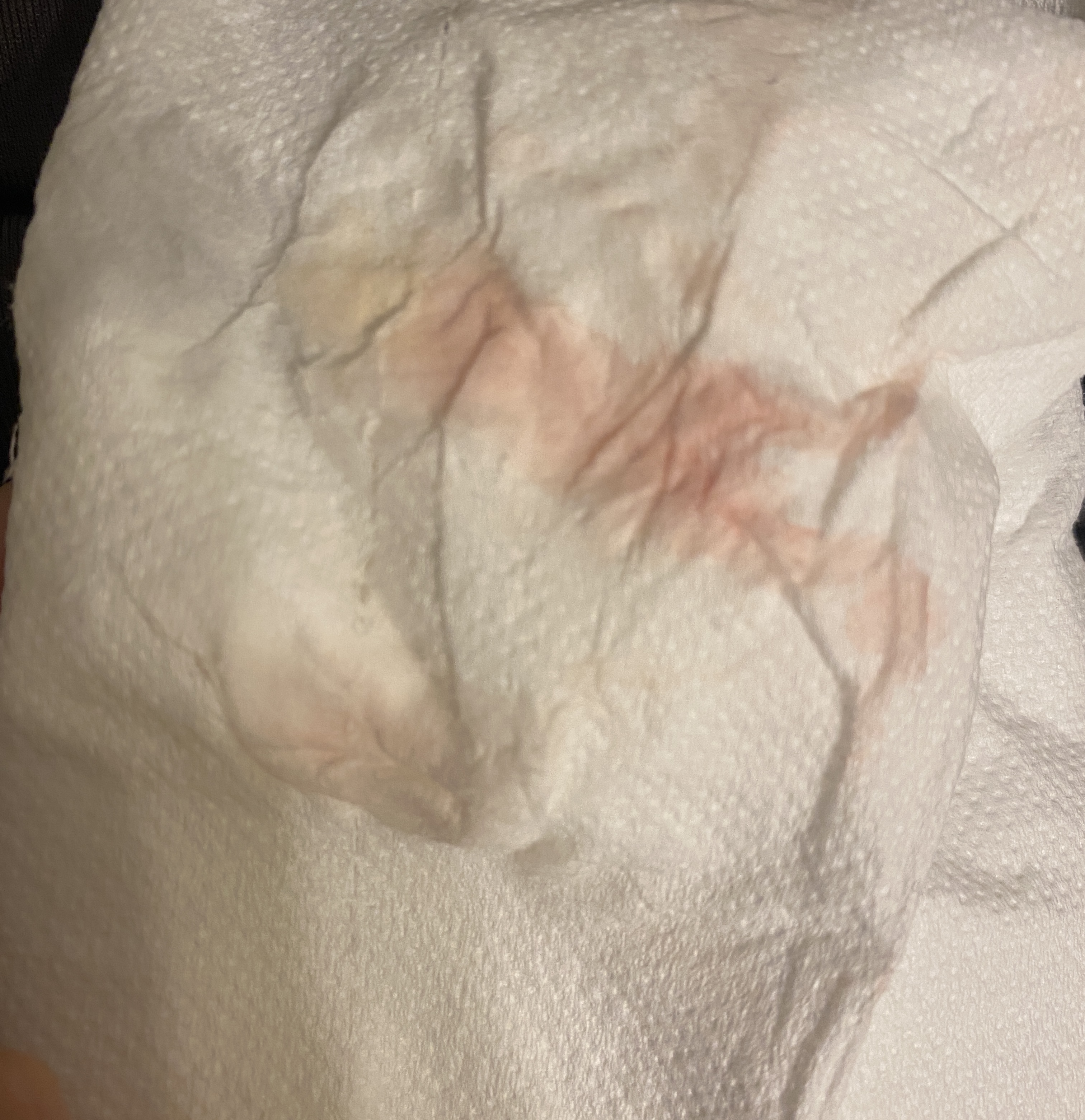 Brown/pink discharge. I am almost 6 weeks and I have been having pink/brown  discharge (no blood) since Saturday. Is anyone else going through this??  Waiting to hear back from my dr.. 