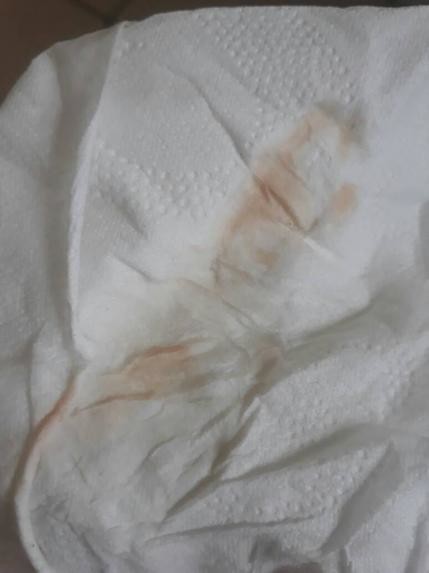 bright red blood on toilet paper after wiping after peeing