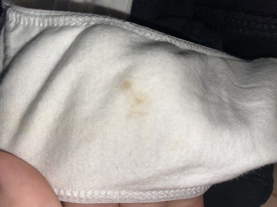Very small amount of brown discharge in pants - TMI picture