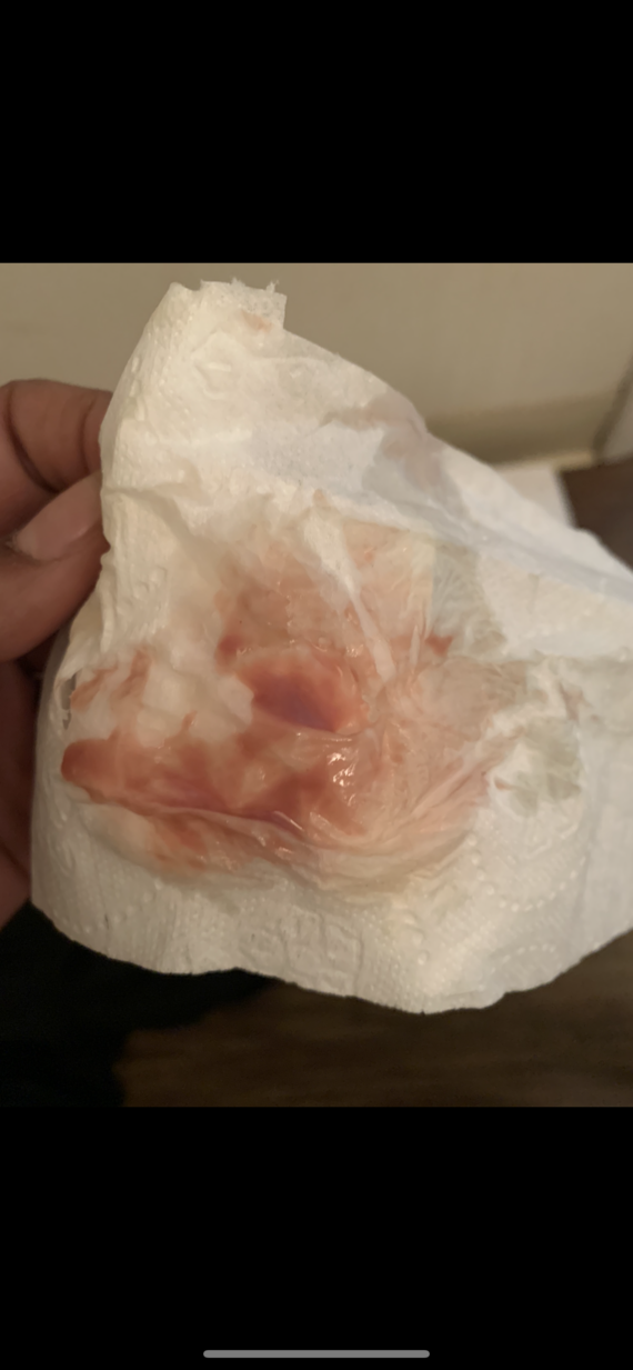 Discharge After Period Pink