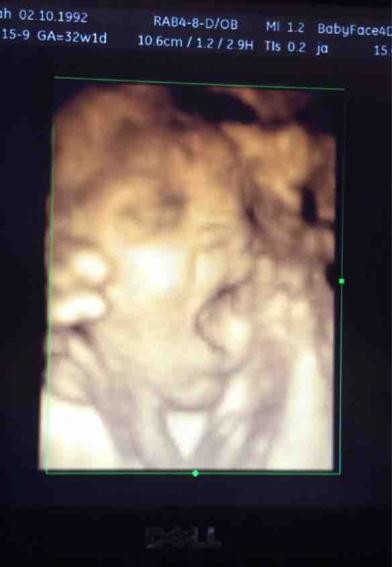 4d Scan 32 Weeks Pregnant