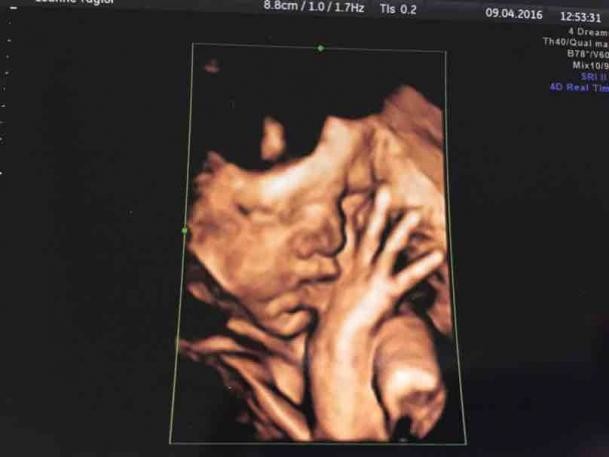 When Is Best To Have A 4d Scan