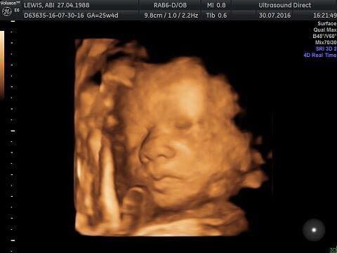 4d scan recommendations?? Manchester or surrounding areas