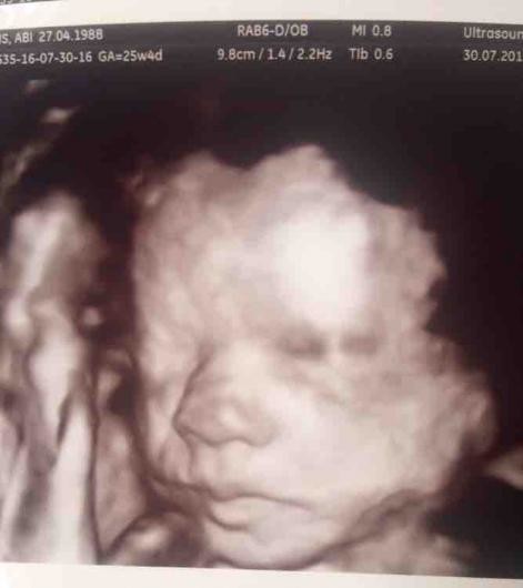 4d scan recommendations?? Manchester or surrounding areas