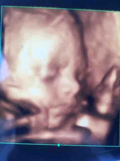 4d scan recommendations?? Manchester or surrounding areas