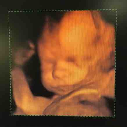 4d scan recommendations?? Manchester or surrounding areas