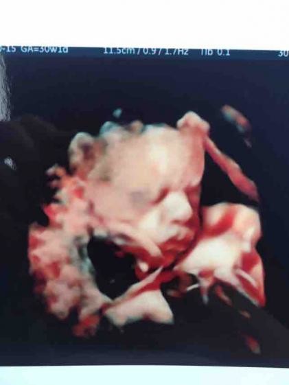 4d scan recommendations?? Manchester or surrounding areas