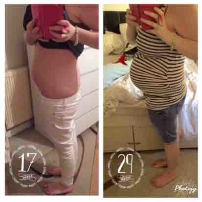 16 Weeks Pregnant  Bump, Symptoms and Baby's Size at 16 Weeks