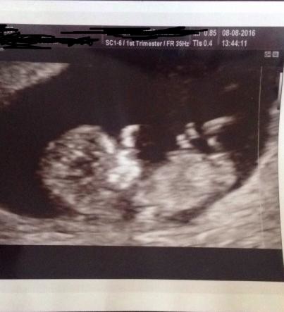 20 week scan - baby not playing ball!! Gender guesses anyone!