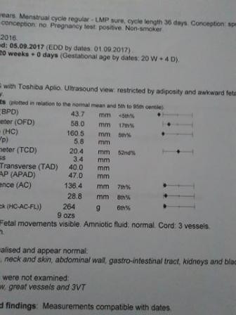 Baby measuring small at 39 weeks orders