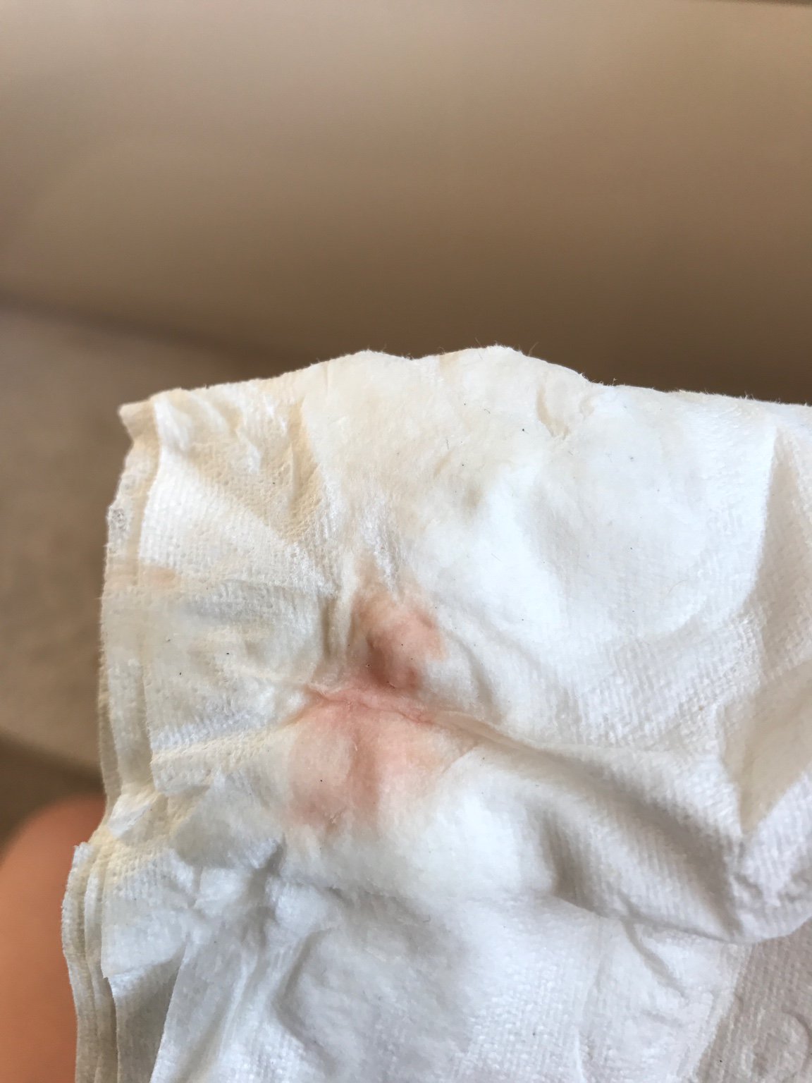 7 weeks bleeding/spotting help!