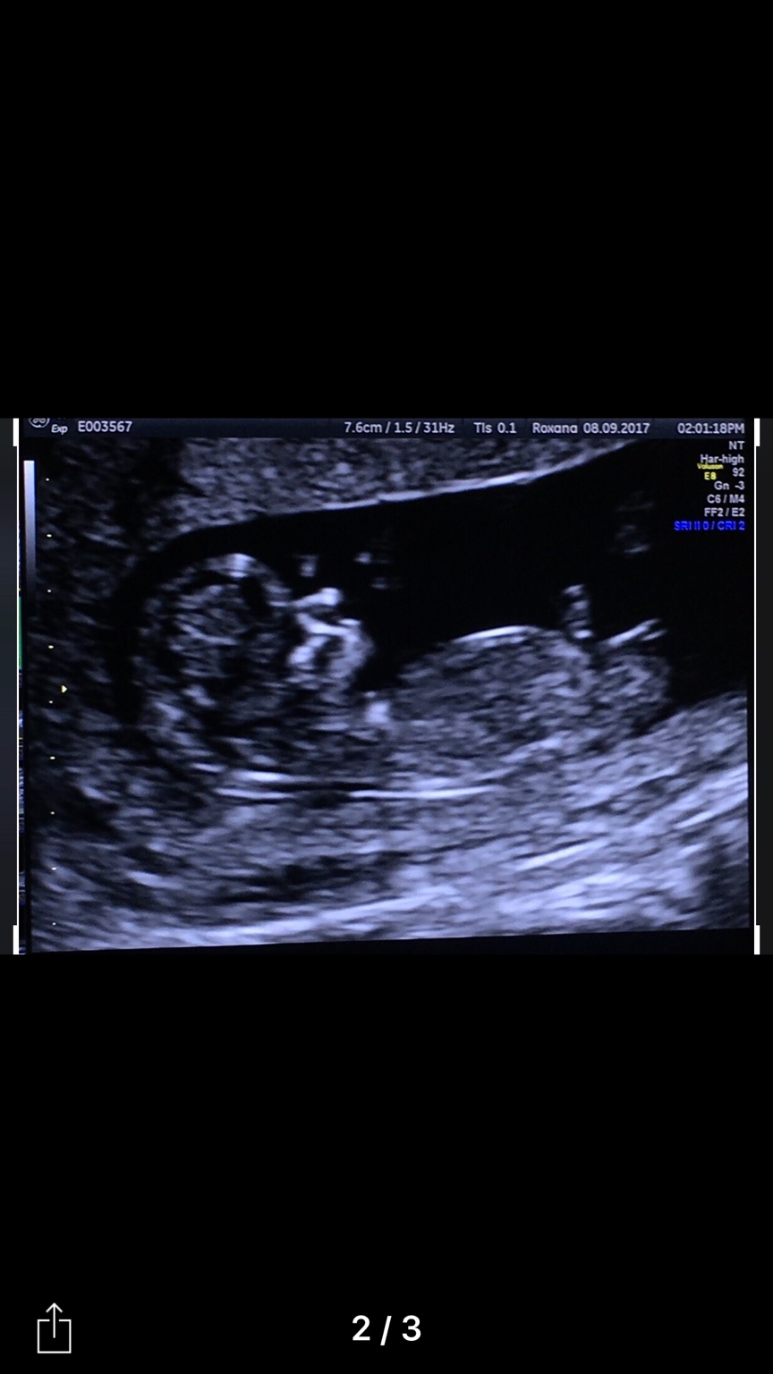 Baby measuring big!!