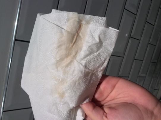 implantation bleeding on toilet paper