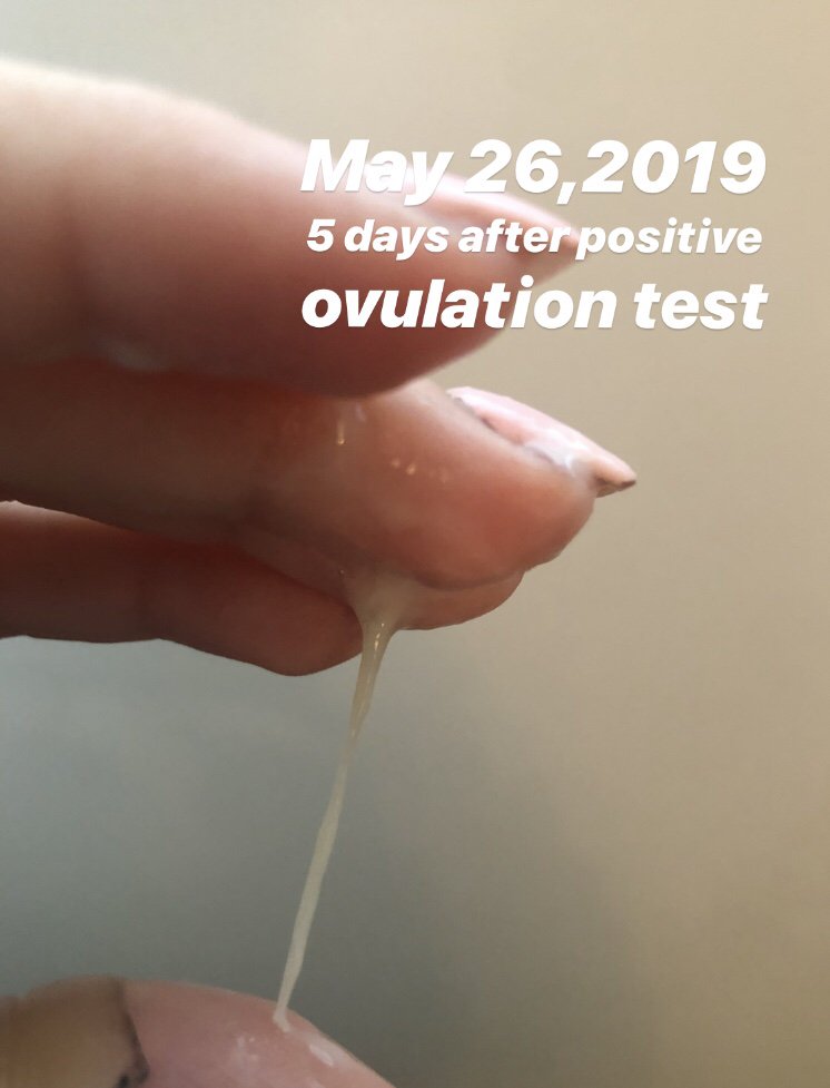 after ovulation discharge