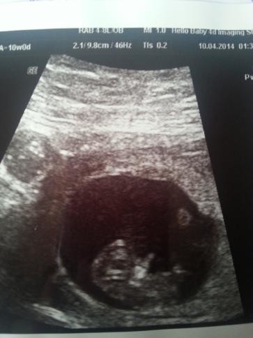 Any 9 week scan pictures?