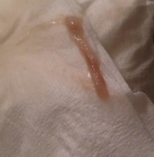 What is this ? Brown stringy blood/discharge : u/therealreal_587