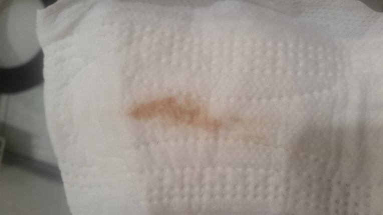 Very small amount of brown discharge in pants - TMI picture