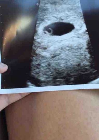 Early scan at 6 weeks, show me your pics!
