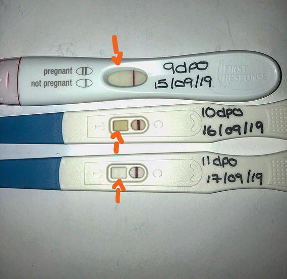 11dpo shooting pain cramp