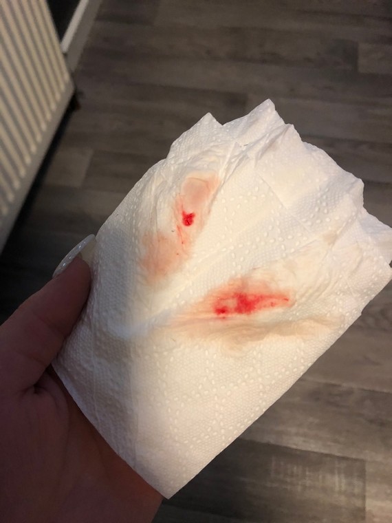 implantation bleeding on toilet paper