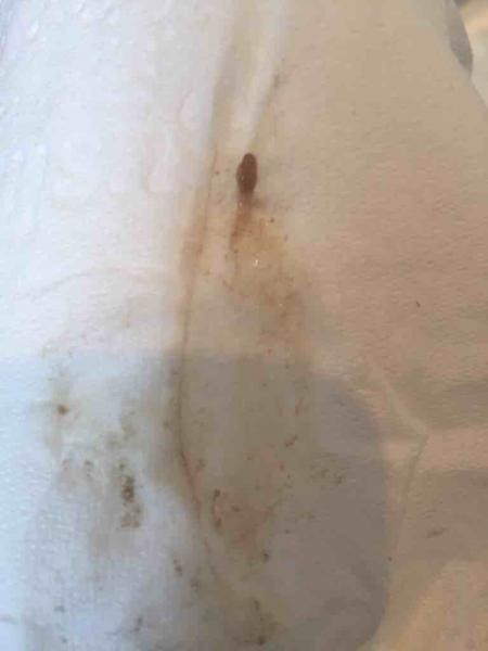 Brown stringy like discharge - Trying to Conceive, Forums