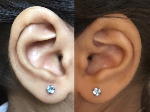 Uneven second ear on sale piercing