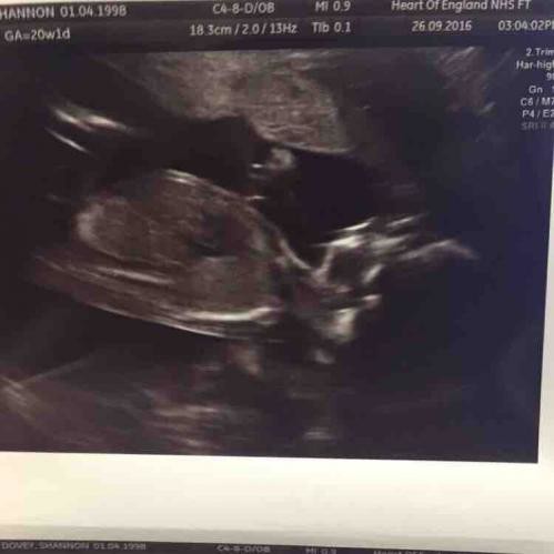 When's your 20 week scan. Let's see those scan pics if you've had it.