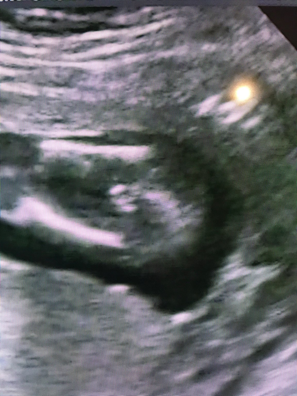 Potty shot 16 weeks boy or girl