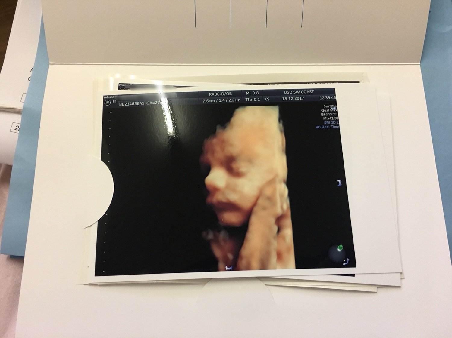 4D scans- yay or nay?