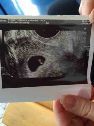 At how may weeks can you see what on an early scan