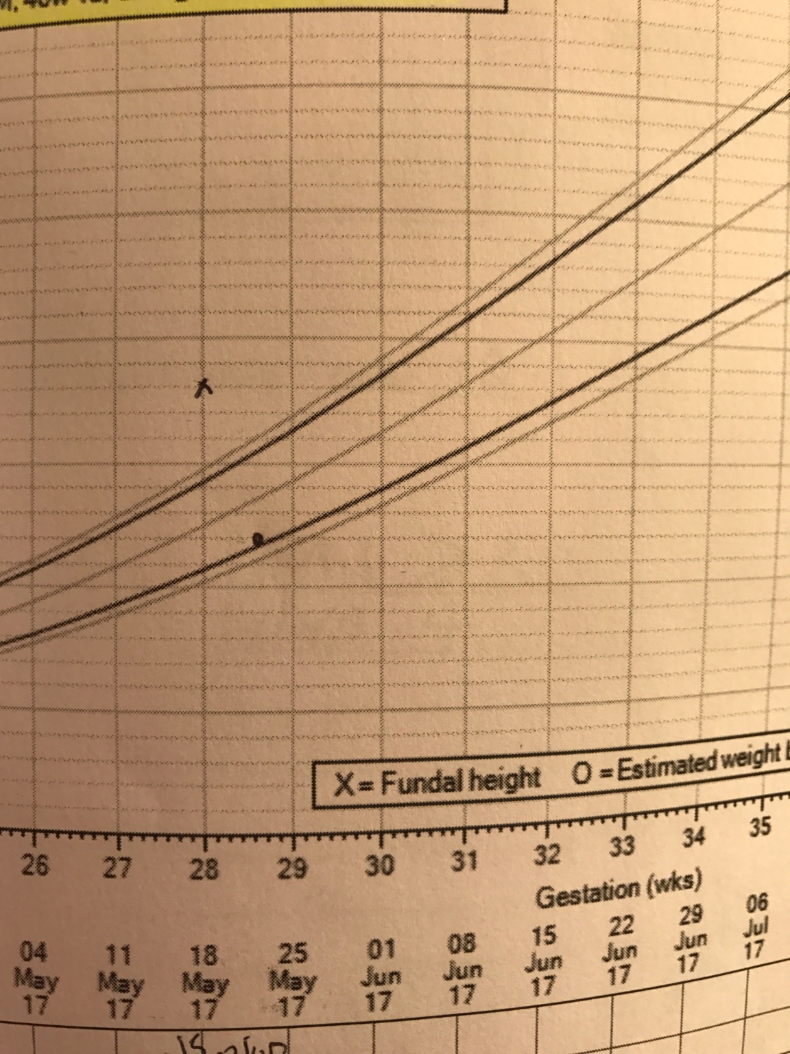 29 weeks and baby measuring small
