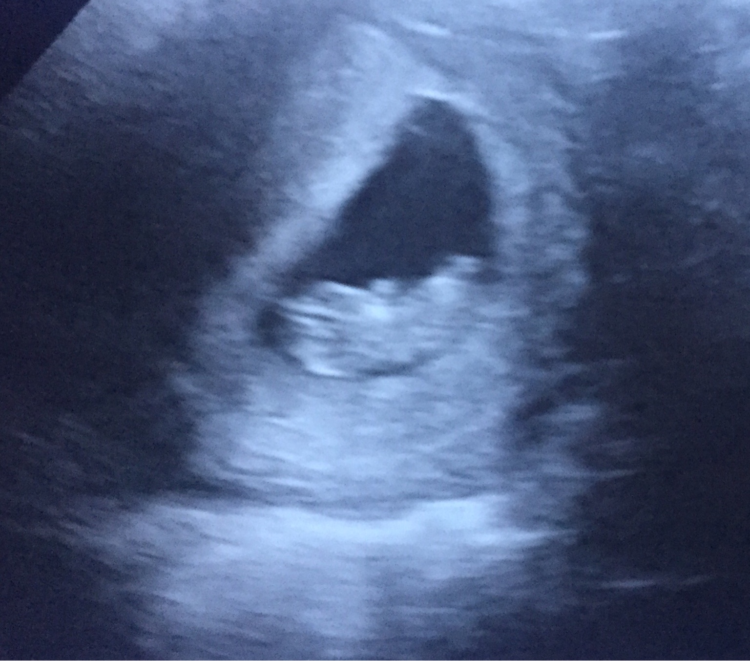 3rd Scan Today!